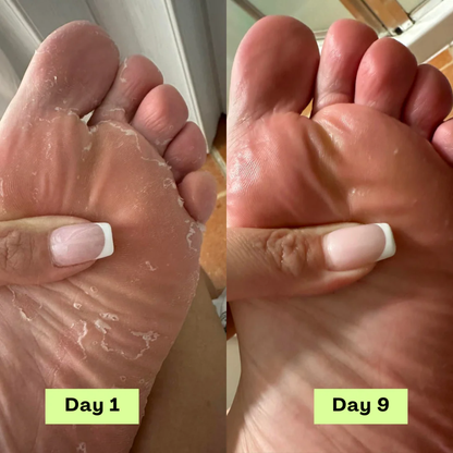 Wonderrelief AntiFungal Relief Soap Bar