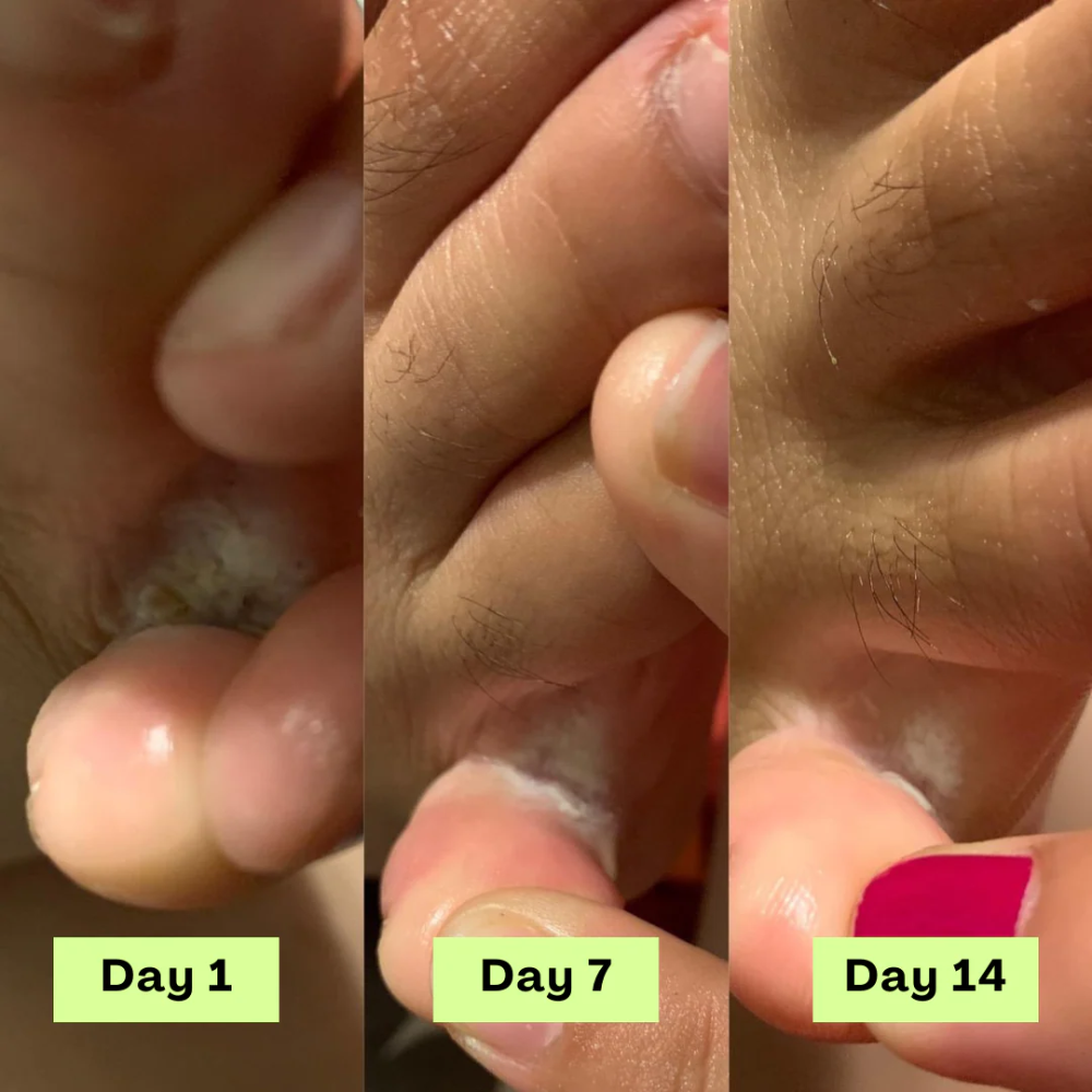 Wonderrelief AntiFungal Relief Soap Bar