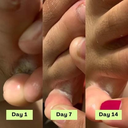 Wonderrelief AntiFungal Relief Soap Bar